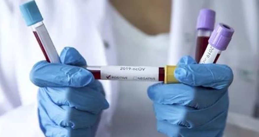 Türkiyədə son koronavirus statistikası açıqlandı Türkiyədə son koronavirus statistikası açıqlandı