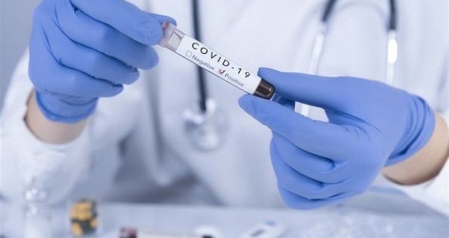 Gürcüstanda COVID-19-a yoluxanların sayı artdı Gürcüstanda COVID-19-a yoluxanların sayı artdı