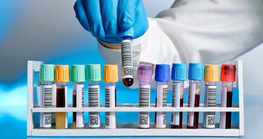 COVID-19 analiz nəticəsini onlayn qaydada əldə etmək mümkün olacaq COVID-19 analiz nəticəsini onlayn qaydada əldə etmək mümkün olacaq