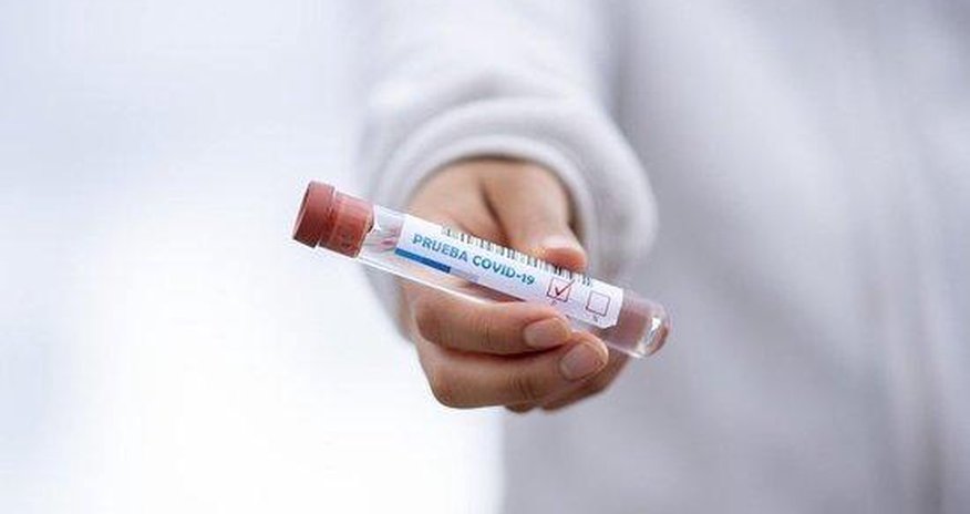 Günün koronavirusa yoluxma statistikası Günün koronavirusa yoluxma statistikası