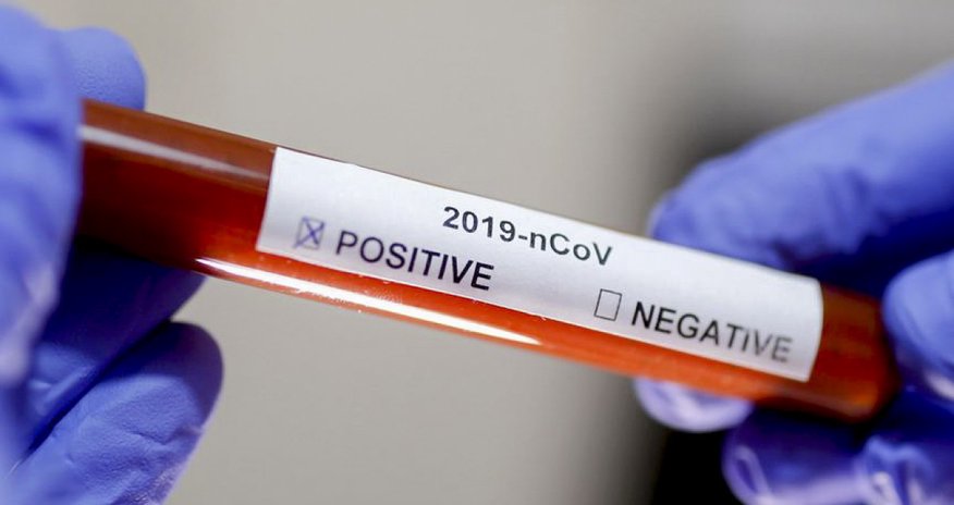 Armenia's coronavirus death toll reaches 4,924 Armenia's coronavirus death toll reaches 4,924