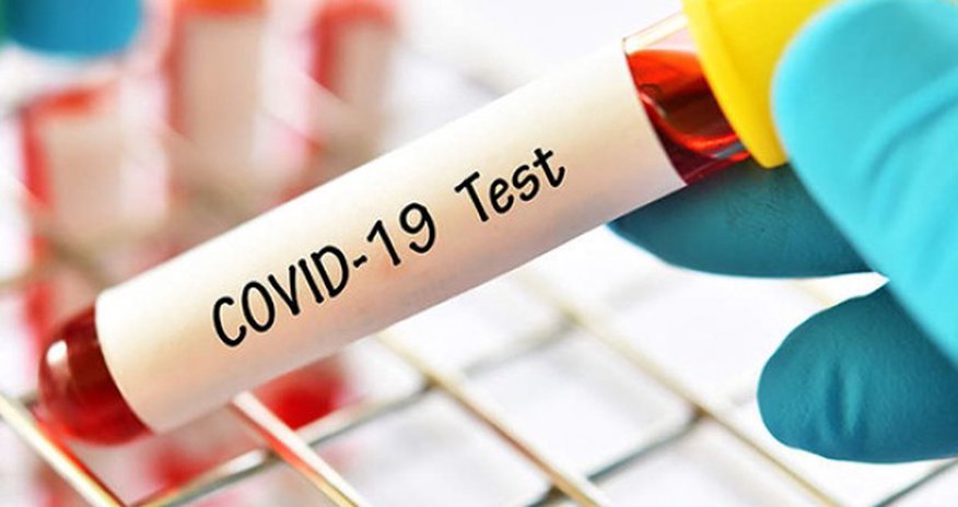 COVID-19 testlərinin fərqli nəticə göstərməsi ilə bağlı RƏSMİ AÇIQLAMA COVID-19 testlərinin fərqli nəticə göstərməsi ilə bağlı RƏSMİ AÇIQLAMA