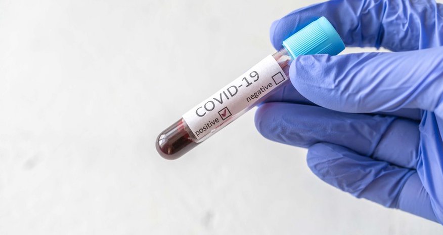 Tələbələri arasında koronavirus aşkarlanan universitetlər - SİYAHI Tələbələri arasında koronavirus aşkarlanan universitetlər - SİYAHI