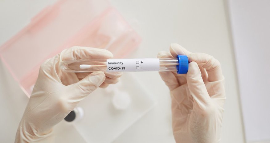 Azerbaijan confirms 2,266 new COVID-19 cases Azerbaijan confirms 2,266 new COVID-19 cases