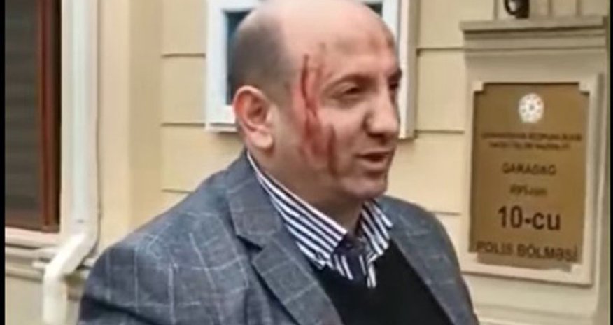 “Sədərək”dəki axundun dəyişdirilməsinə etiraz edən şəxs həbs edildi - VİDEO “Sədərək”dəki axundun dəyişdirilməsinə etiraz edən şəxs həbs edildi - VİDEO