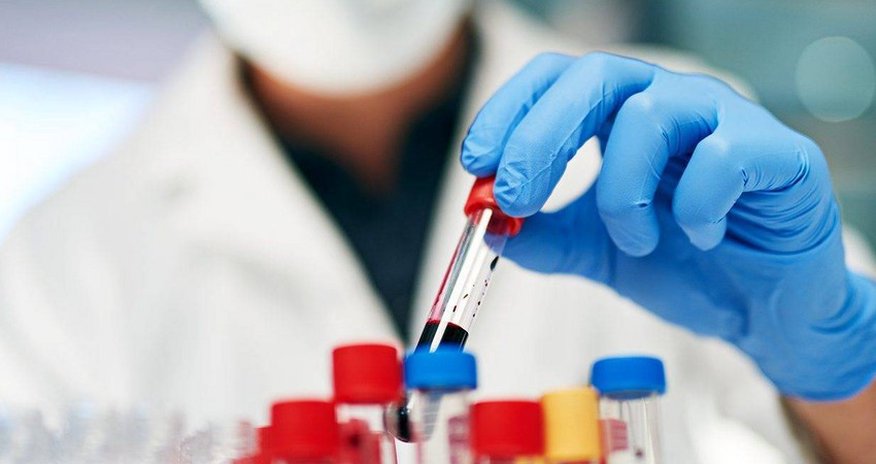 Omicron strain not detected in Azerbaijan Omicron strain not detected in Azerbaijan