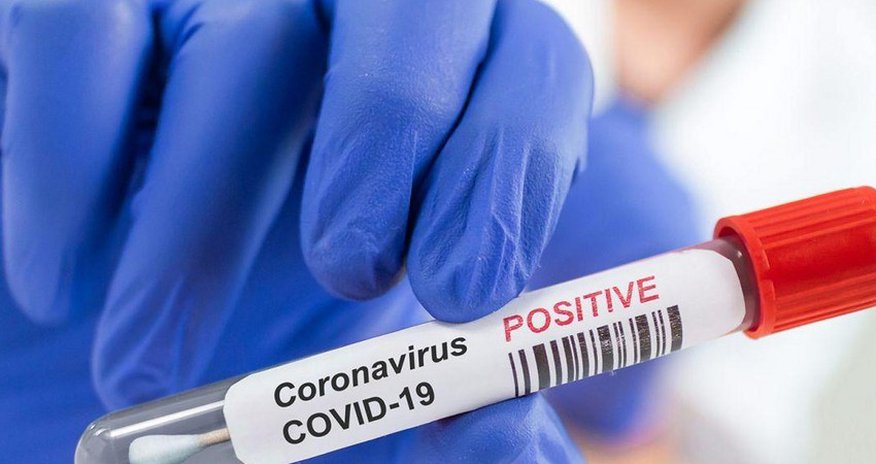 Today's statistics of COVID-19 in Azerbaijan Today's statistics of COVID-19 in Azerbaijan