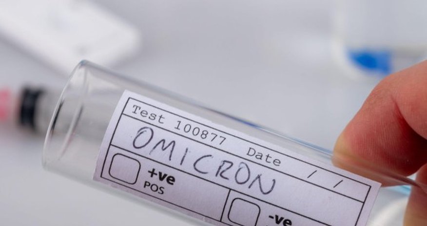 Türkiyədə "omikron" ştamına kütləvi yoluxma qeydə alındı Türkiyədə "omikron" ştamına kütləvi yoluxma qeydə alındı