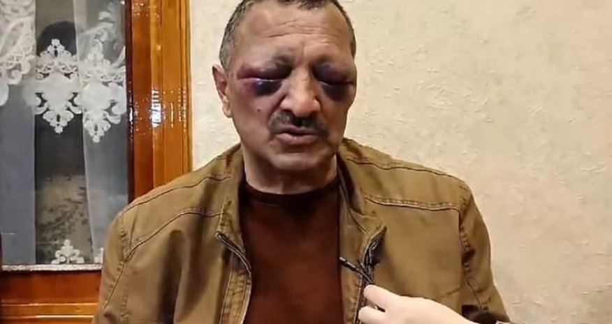 Tofiq Yaqublunun döyülməsi ilə bağlı araşdırma yekunlaşdı Tofiq Yaqublunun döyülməsi ilə bağlı araşdırma yekunlaşdı