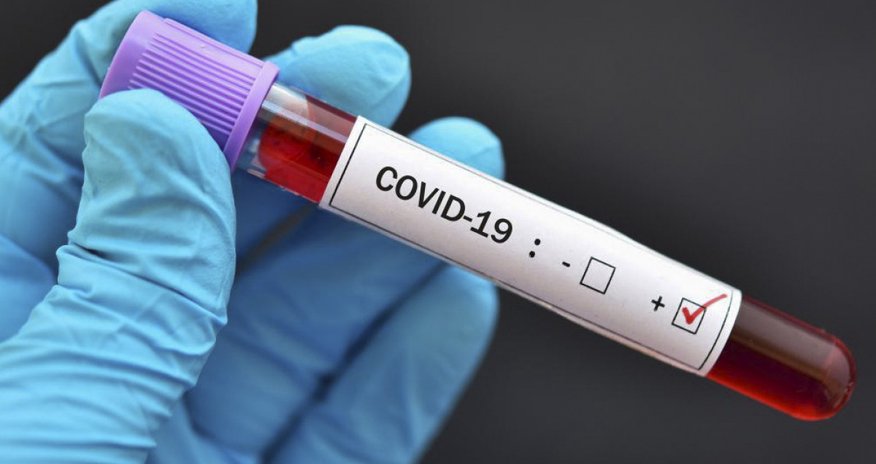 Gürcüstanda daha 87 nəfərdə COVİD aşkarlanıb Gürcüstanda daha 87 nəfərdə COVİD aşkarlanıb