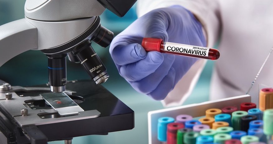 Azərbaycanda koronavirusla bağlı statistika Azərbaycanda koronavirusla bağlı statistika