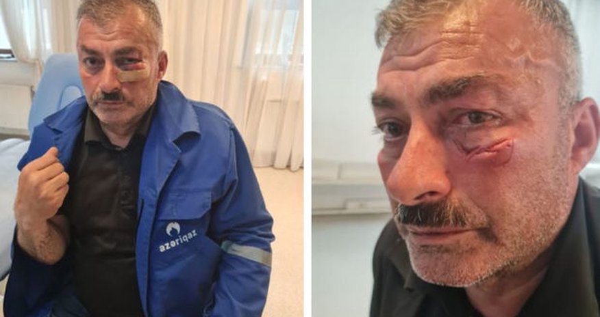 “Azəriqaz”ın əməkdaşına qarşı zor tətbiqi ilə bağlı cinayət işi başlanıb “Azəriqaz”ın əməkdaşına qarşı zor tətbiqi ilə bağlı cinayət işi başlanıb