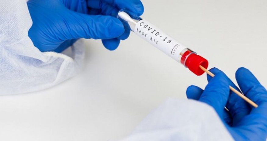 Bu ölkədə PCR testi ləğv edilir Bu ölkədə PCR testi ləğv edilir