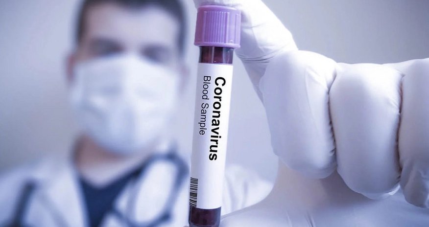 Azerbaijan reports 69 new COVID-19 cases Azerbaijan reports 69 new COVID-19 cases