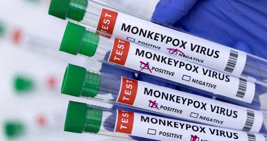 TABIB announces methods of protection against monkeypox TABIB announces methods of protection against monkeypox