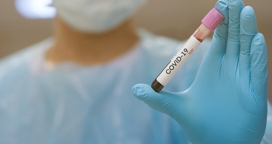 Azerbaijan confirms 325 new COVID-19 cases, 7 deaths Azerbaijan confirms 325 new COVID-19 cases, 7 deaths