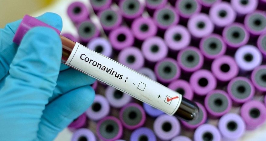 Koronavirusla bağlı SON STATİSTİKA Koronavirusla bağlı SON STATİSTİKA