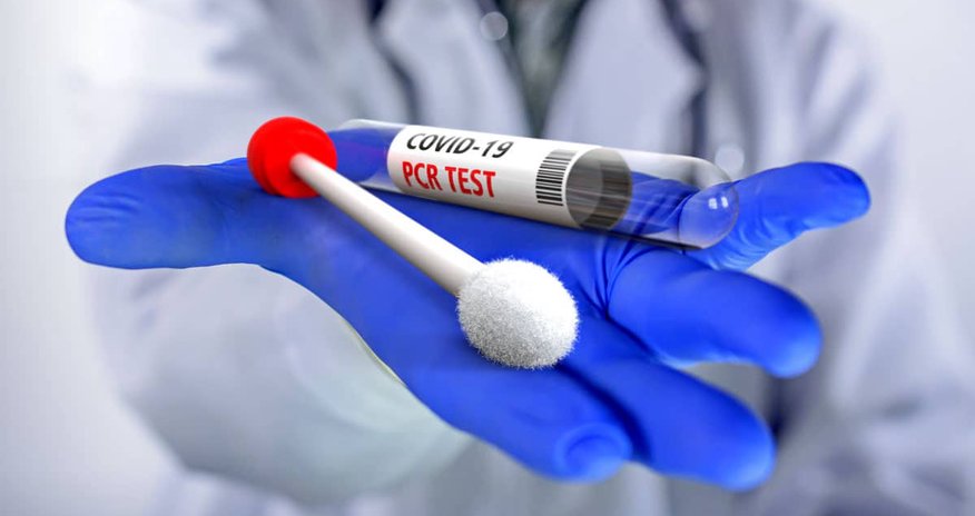 Çin ölkəyə giriş üçün COVİD-19 testi tələbini ləğv edir Çin ölkəyə giriş üçün COVİD-19 testi tələbini ləğv edir