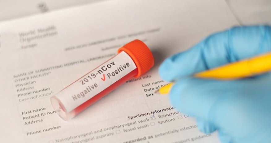 Azerbaijan reports 62 new COVID-19 cases Azerbaijan reports 62 new COVID-19 cases