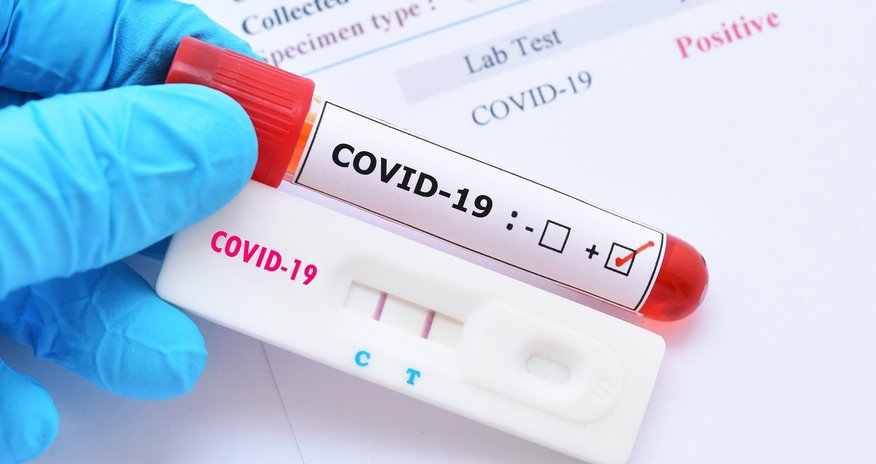 Azərbaycanda son gündə COVID-19-a yoluxanların və peyvənd olunanların sayı açıqlanıb Azərbaycanda son gündə COVID-19-a yoluxanların və peyvənd olunanların sayı açıqlanıb
