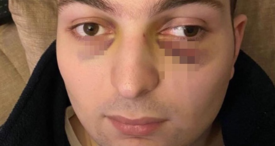 Ticarət mərkəzində döyülən oğlanla bağlı araşdırma başlanılıb Ticarət mərkəzində döyülən oğlanla bağlı araşdırma başlanılıb