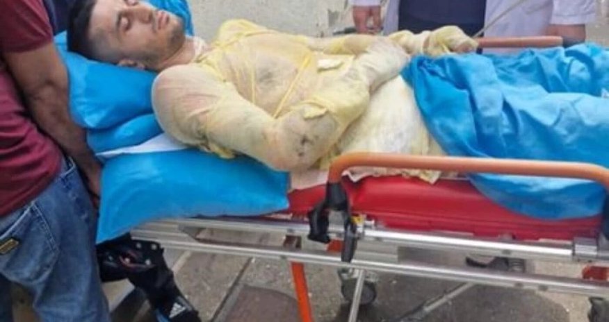 Qız qaçıran qazi özünü yandırıb Qız qaçıran qazi özünü yandırıb