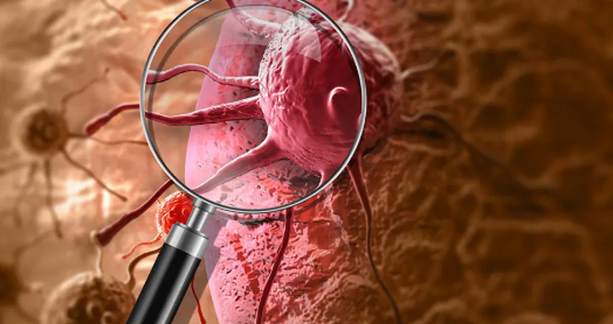 Scientists develop blood test to detect throat cancer years before symptoms Scientists develop blood test to detect throat cancer years before symptoms