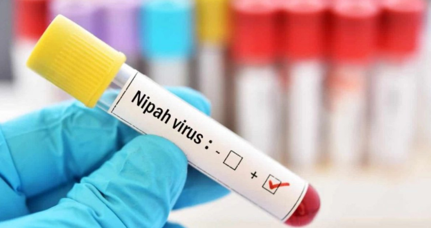 Nipah и глобальная уязвимость: может ли риск дойти до Азербайджана? Nipah и глобальная уязвимость: может ли риск дойти до Азербайджана?