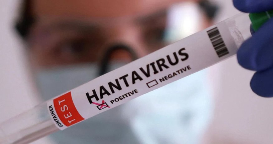 Kanadada hantavirusa yoluxma aşkarlanıb Kanadada hantavirusa yoluxma aşkarlanıb