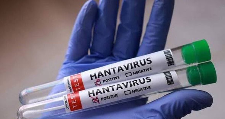 Hantavirusa yoluxanların sayı 13-ə çatıb Hantavirusa yoluxanların sayı 13-ə çatıb