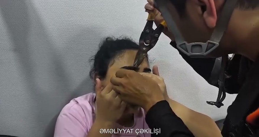 Göz qapağı geyiminin zəncirbəndinə ilişən qadına köməklik göstərilib - Video Göz qapağı geyiminin zəncirbəndinə ilişən qadına köməklik göstərilib - Video